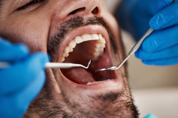 Best Tooth Infection Emergency Dentist  in Hyrum, UT
