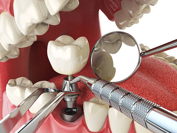 Best Urgent Tooth Repair  in Hyrum, UT